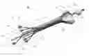 Fig. 01 - Brachytherapy Applicator
