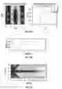 Fig. 19 - Implants using ultrasonic backscatter for sensing physiological conditions