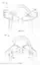 Fig. 03 - Device for improving form and function of sports people