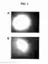 Fig. 06 - Assay Devices and Methods for the Detection of Analytes