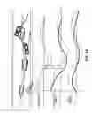 Fig. 17 - Lane keeping assist device