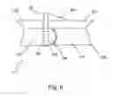 Fig. 06 - Multidirectional transport system