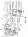 Fig. 06 - Sub-frame method and arrangement for retaining a rear section of a sub-frame