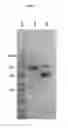 Fig. 02 - Vegetative insecticidal proteins useful for control of insect pests