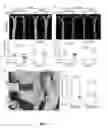 Fig. 02 - THERAPEUTICS AND METHODS OF TREATING FIBROPROLIFERATIVE DISEASES