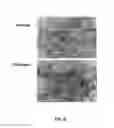 Fig. 07 - ANTIBODIES AGAINST PHOSPHORYLCHOLINE