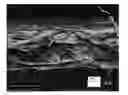 Fig. 01 - Breathable films with microbial barrier properties