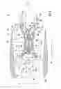 Fig. 02 - Tooling fixture assembly for processing a component of a gas turbine engine