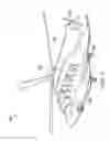 Fig. 02 - Oil filter with impending and full-bypass indicators