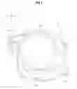 Fig. 06 - Engine side cover structure of saddle type vehicle