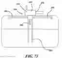 Fig. 49 - Electrically controlled fuel system module