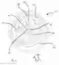 Fig. 04 - Directional valve, especially for breathing gases, and method for manufacturing same