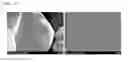 Fig. 08 - Positive electrode active material for lithium secondary battery, method for preparing the same, and secondary battery including the same