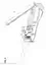 Fig. 09 - Connector with separable lacing fixture