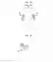 Fig. 02 - Binaural cue preservation in a bilateral system