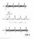 Fig. 07 - Biological signal processing device and blood pressure measurement system