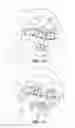 Fig. 02 - Detecting stress based on thermal measurements of the face