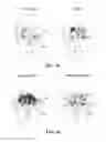 Fig. 17 - User state selection based on the shape of the exhale stream