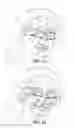 Fig. 02 - Detecting an allergic reaction from nasal temperatures