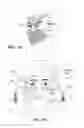 Fig. 08 - Detecting an allergic reaction from nasal temperatures