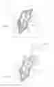 Fig. 02 - METHODS AND SYSTEMS OF POSITIONING AN IMPLANT
