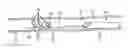 Fig. 01 - Apparatus and methods for removing obstructive material from body lumens