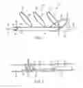 Fig. 02 - Apparatus and methods for removing obstructive material from body lumens