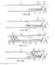 Fig. 03 - Apparatus and methods for removing obstructive material from body lumens