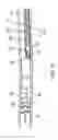 Fig. 09 - Apparatus and methods for removing obstructive material from body lumens