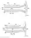 Fig. 08 - Systems and methods for a surgical tissue manipulator