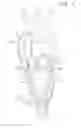 Fig. 02 - PROSTHETIC HEART VALVE WITH CUSP POSITIONERS