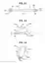 Fig. 09 - Methods and devices for delivering and affixing tissue scaffolds