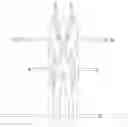 Fig. 01 - System for fixation of flexible stretcher to hard stretcher