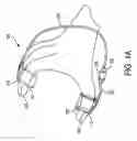 Fig. 02 - Wearable sensor devices and systems for patient care