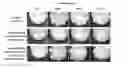 Fig. 01 - Dental composition
