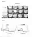 Fig. 03 - Dental composition