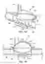 Fig. 02 - Automatic detection and adjustment of a pressure pod diaphragm