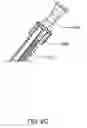 Fig. 34 - Infusion pump assembly
