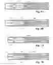 Fig. 05 - Injection device