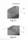 Fig. 07 - Dry powder inhalers with partial dosage delivery