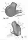 Fig. 20 - Dry powder inhalers with partial dosage delivery