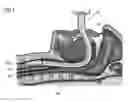 Fig. 02 - Cuff-pressure control device, cuff-attached tracheal tube, and ventilator