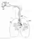 Fig. 01 - Medical tubes for selective mechanical ventilation of the lungs