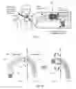 Fig. 06 - Tracheal tube apparatus and methods