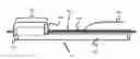 Fig. 01 - Balloon catheter systems