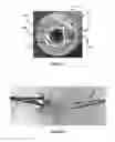 Fig. 05 - Balloon catheter systems