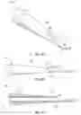 Fig. 09 - Catheter with an asymmetric tip