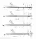 Fig. 03 - Apparatus and methods for treating obstructions within body lumens