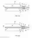 Fig. 05 - Apparatus and methods for treating obstructions within body lumens