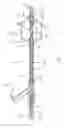 Fig. 09 - Apparatus and methods for treating obstructions within body lumens